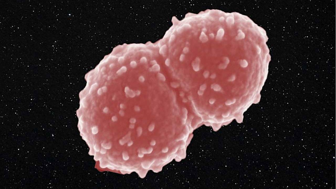 Deinococcus radiodurans survived an entire year outside the ISS