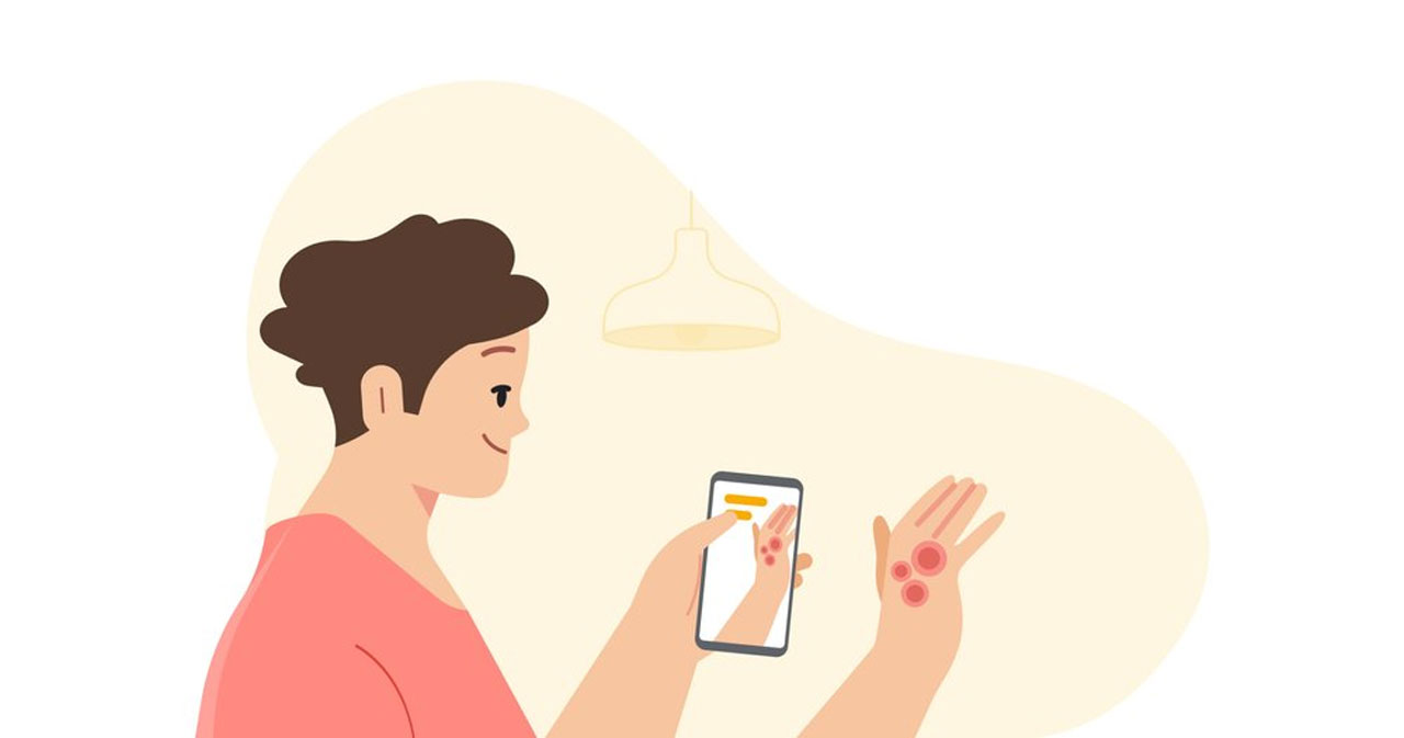 Google previews AI-powered app for diagnosing skin conditions
