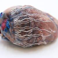 Biosensors created using biocompatible ink could be useful during surgery