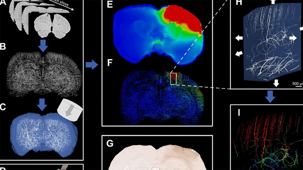 Traumatic brain injury computer model maps brain blood vessels