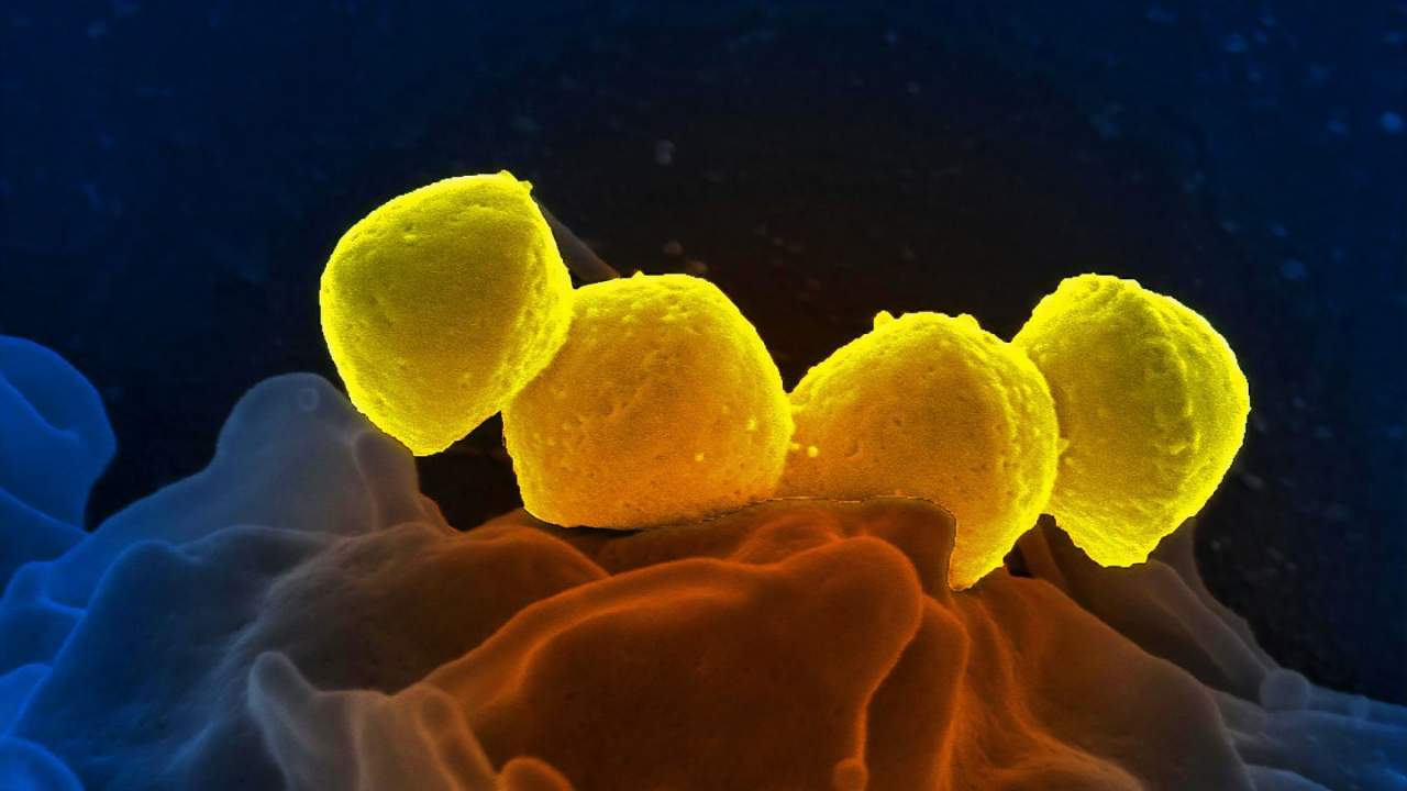 DARPA reveals the teams that’ll target superbugs under HEALR project
